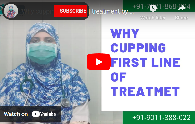 Why cupping first line of treatment