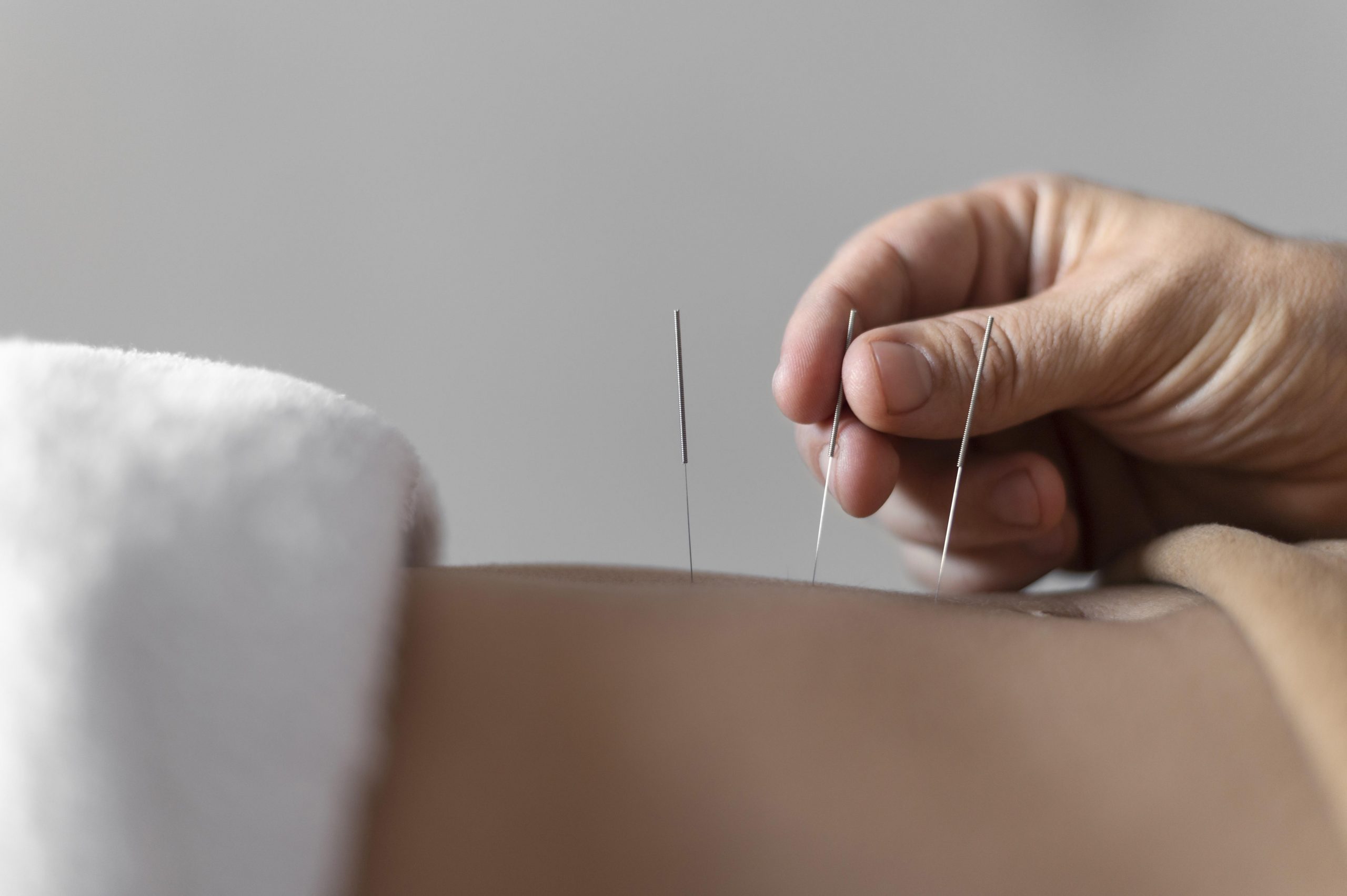 https://hijamahouse.com/wp-content/uploads/2023/01/close-up-hand-holding-acupuncture-needle-scaled.jpg